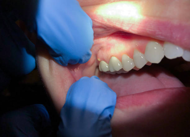 Best Pediatric Emergency Dentist in Sebree, KY